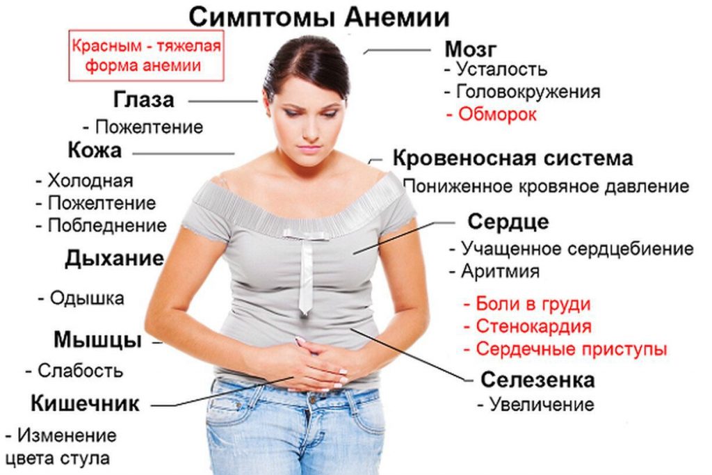 Женщина с описанием симптомов анемии